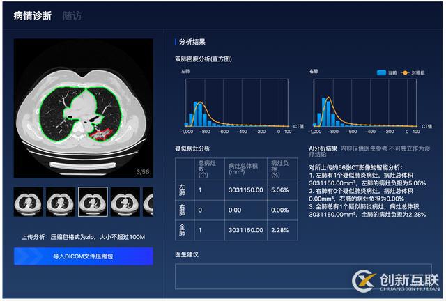百度「AI戰(zhàn)疫」：首次開源肺炎CT影像分析模型，讓診斷從分鐘到秒